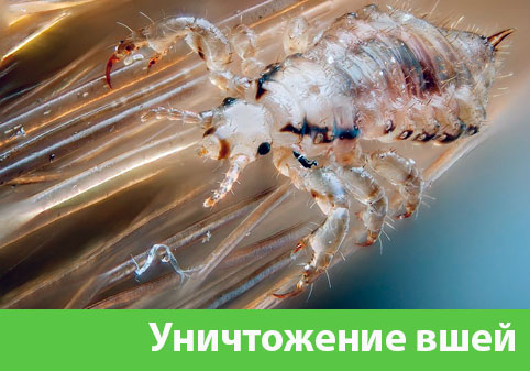 Уничтожение вшей в городе Чехов